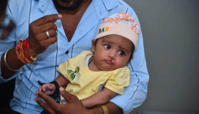 Rotary and Amrita Hospital Join Hands to Restore Smiles with Free Cleft Lip Surgeries for Children